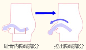 药物治疗阴茎短小果吗